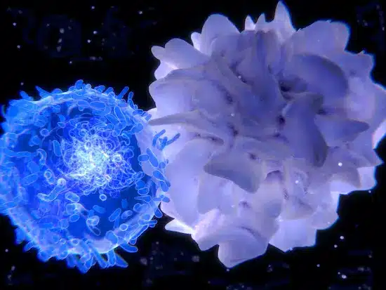 breast cancer dendritic cell vaccine in Germany - GermanyHealth